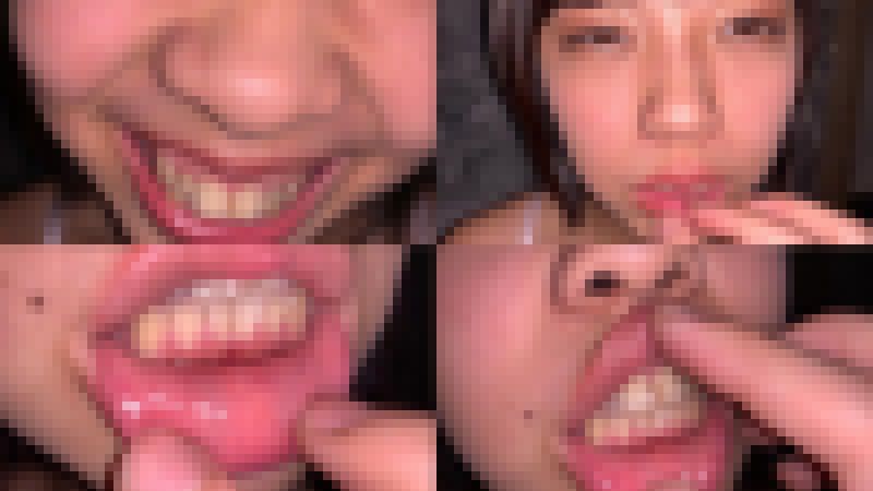 歯姫 31人目 [FBOM-00081] サンプル画像